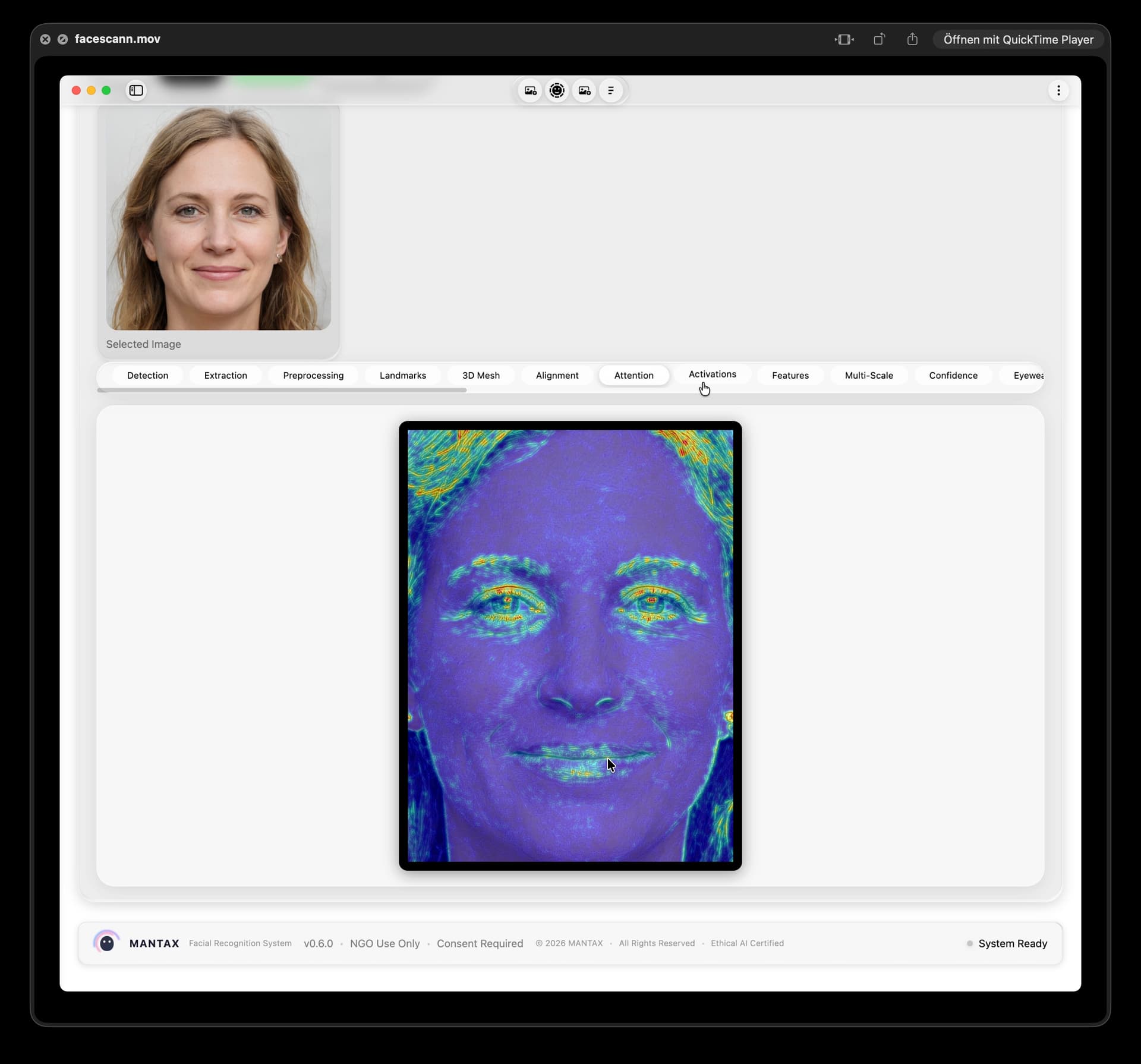 Neural Activationen